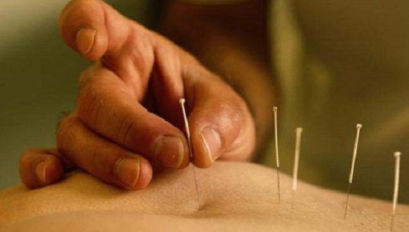 Diversas modalidades de la medicina tradicional cubana