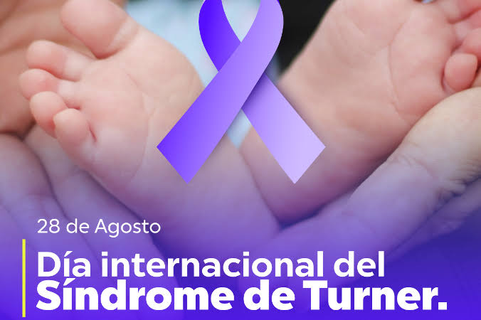 Cero estigmas y prejuicios sobre Síndrome de Turner